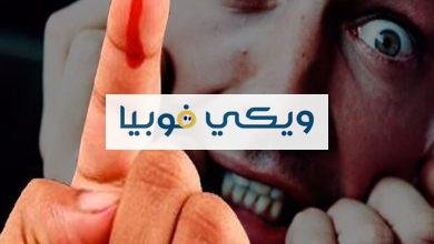 اعراض فوبيا الدم: كيف تتخلص من فوبيا سحب الدم؟ اعراض فوبيا الدم