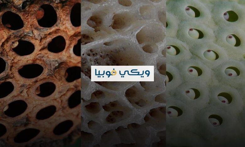 ما سبب مرض رهاب النخاريب؟ المحفزات و5 طرق هامة للعلاج سبب مرض رهاب النخاريب