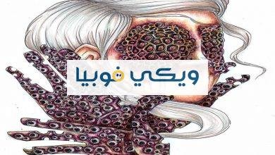 فوبيا النخاريب: دليل شامل عن أعراضها ومثيراتها وطرق علاجها فوبيا النخاريب