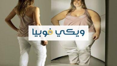 فوبيا زيادة الوزن: أعراض، أسباب، علاج فوبيا الخوف من السُمنة فوبيا زيادة الوزن