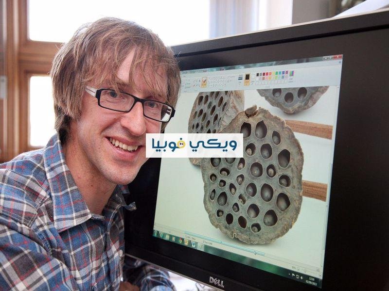كيفية التخلص من فوبيا الثقوب أسباب وأعراض وعلاج كيفية التخلص من فوبيا الثقوب
