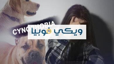 كيف تتخلص من فوبيا الكلاب بنفسك دون معالج نفسي؟ كيف تتخلص من فوبيا الكلاب