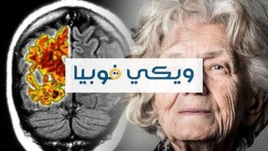 مرض الزهايمر: دليل شامل عن مرض آلزهايمر أو خرَف الشيخوخة مرض الزهايمر