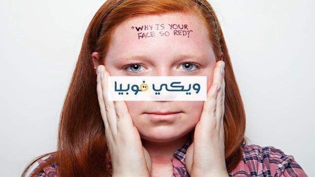 هل احمرار الوجه مرض نفسي ومتى يكون خطيرًا ويتطلب العلاج؟ هل احمرار الوجه مرض نفسي